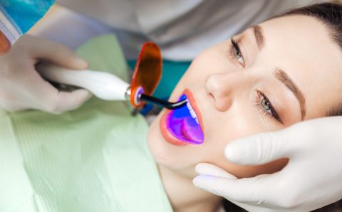Why Availing The Professional Teeth Whitening Services Is A Good Idea For People?